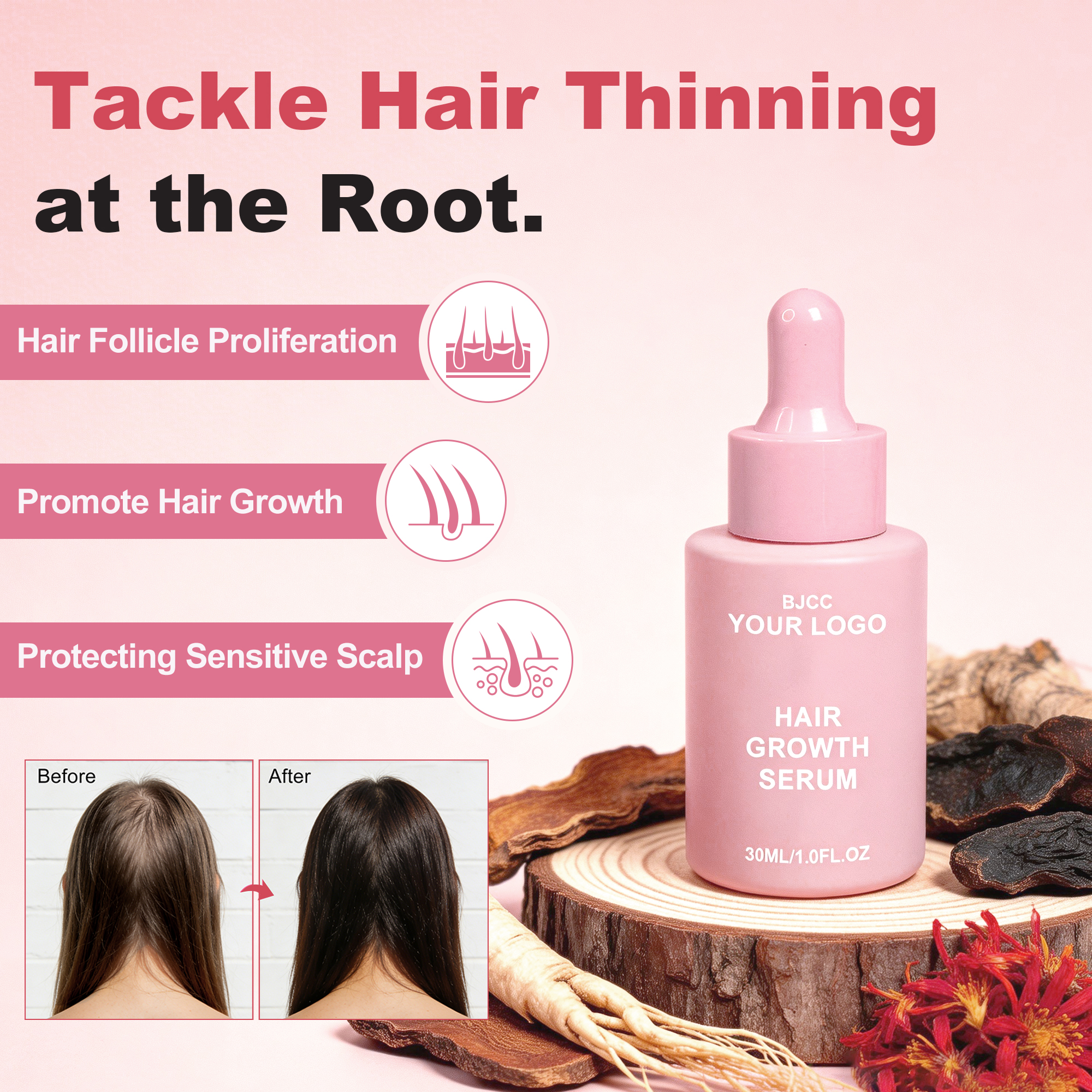 Private Label 100% Natural Organic Men Women Scalp Care Serum Wholesale Herbal Anti Hair Loss Boosting Hair Treatment Growth Oil
