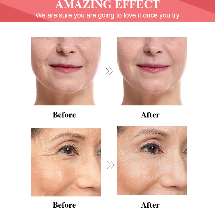 Blue Copper Peptide Serum Showcase 5