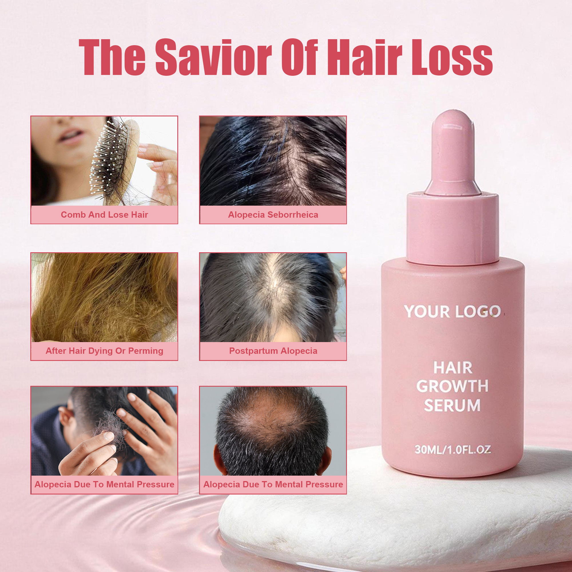 Private Label 100% Natural Organic Men Women Scalp Care Serum Wholesale Herbal Anti Hair Loss Boosting Hair Treatment Growth Oil