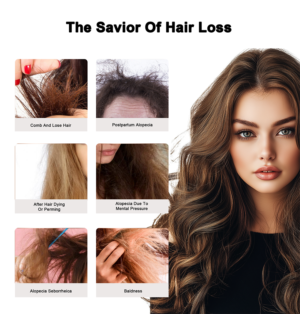 Private Label 100% Natural Organic Men Women Scalp Care Serum Wholesale Herbal Anti Hair Loss Boosting Hair Treatment Growth Oil